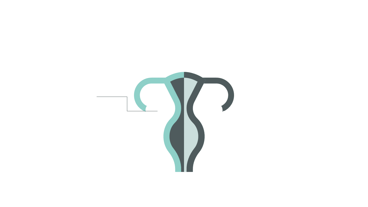 Uterine Structure Infographic for Clear Communication
