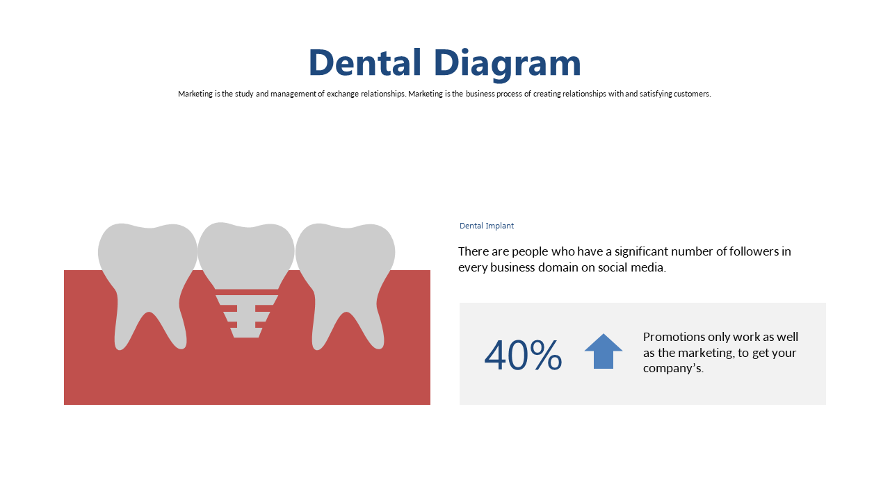 Dental Implants with Marketing Insights Diagram